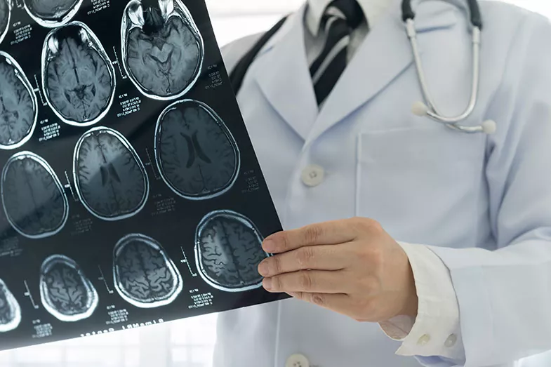 Neurologia